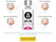 Tru Skin Tag Remover.JPG